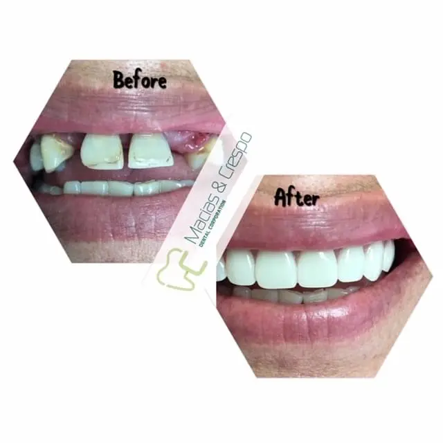 Before & After