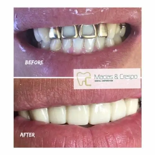 Before & After