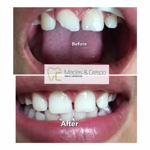 Before & After