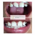 Before & After
