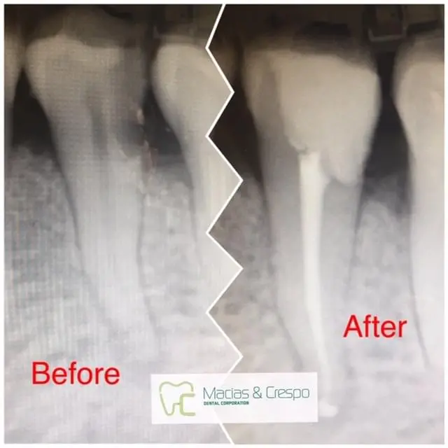 Before & After