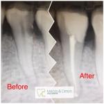 Before & After