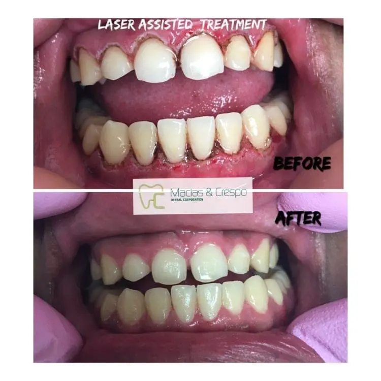 Before & After