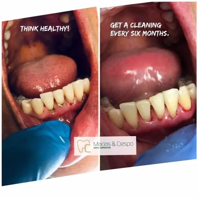 Before & After